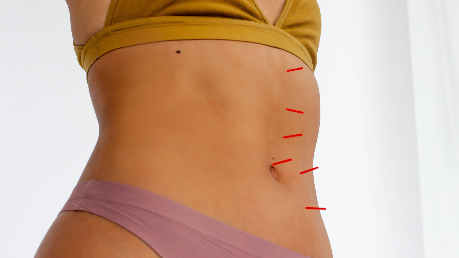 Benefits Of Acupuncture