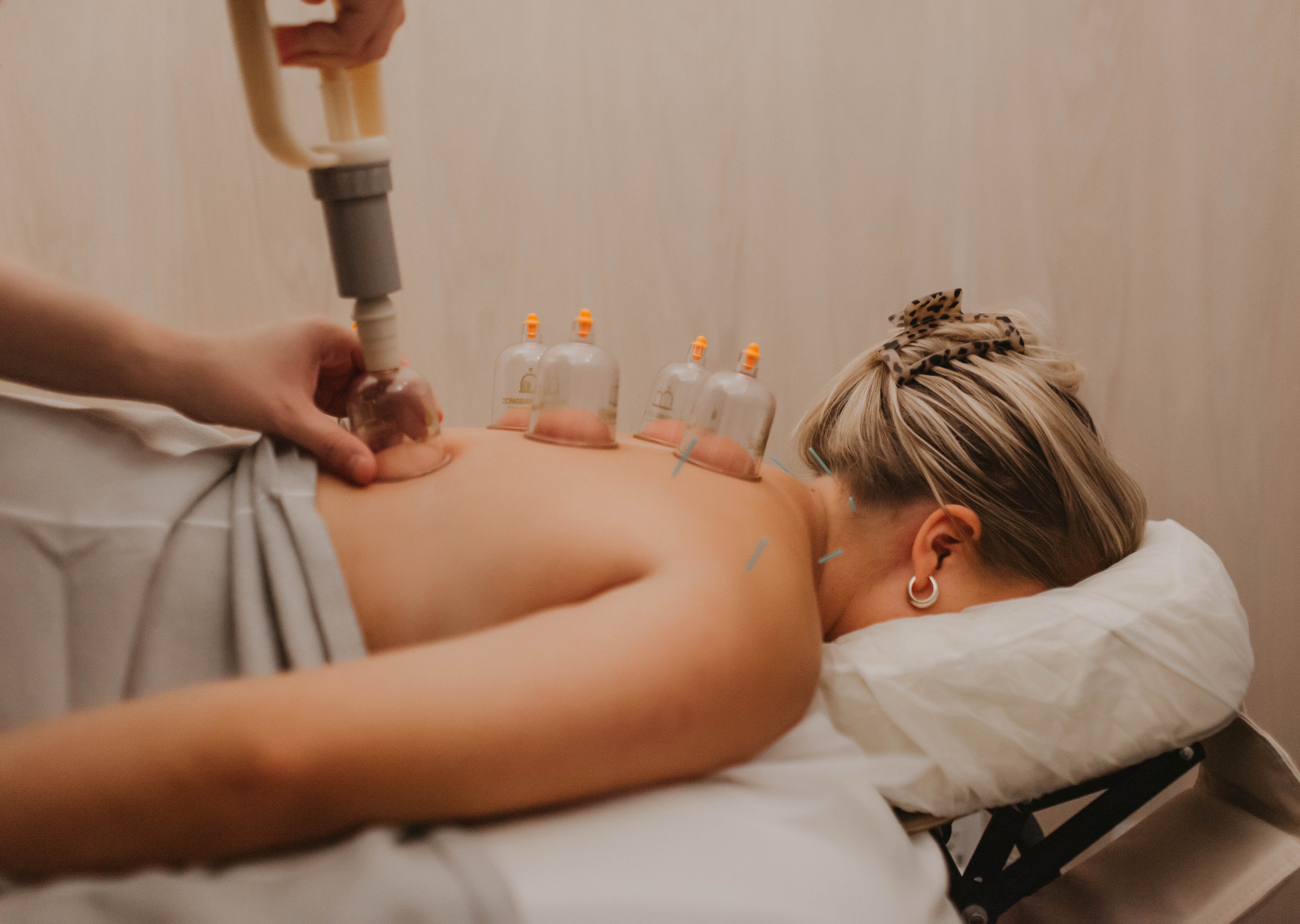 Acupuncture in New York City for Modern Life - WTHN