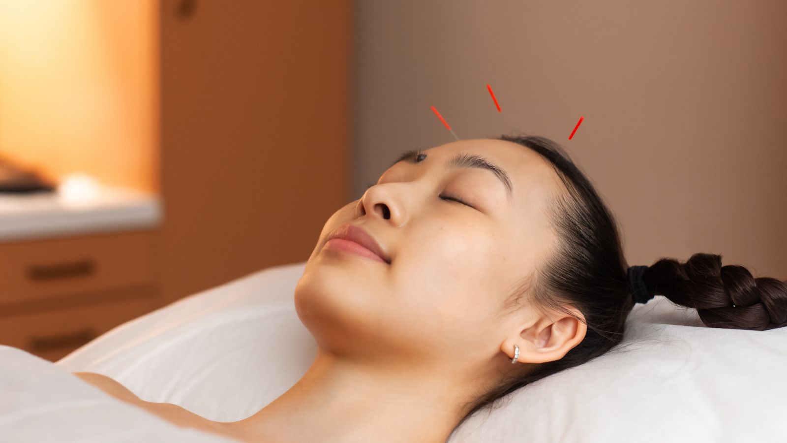  Acupuncture For Allergies