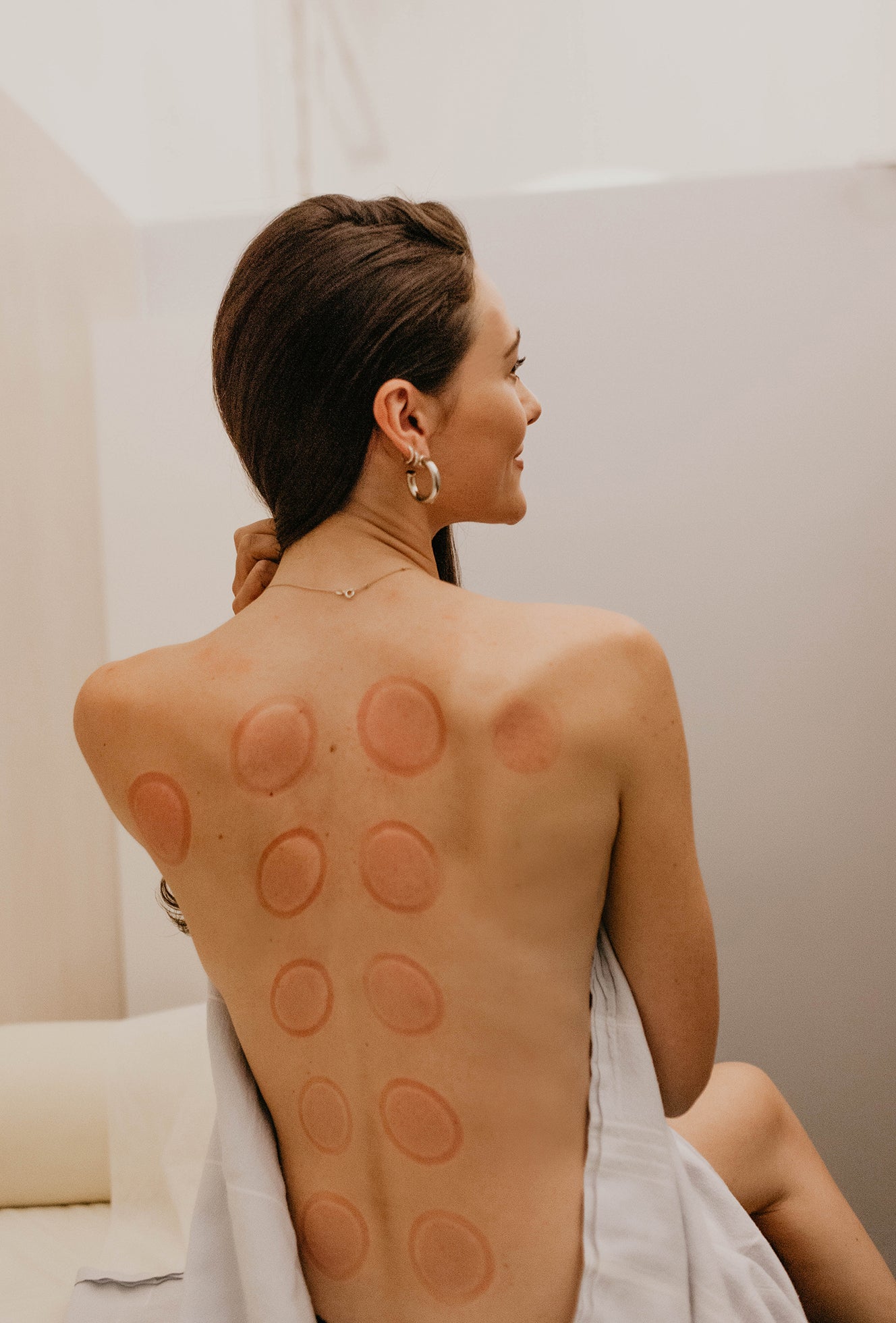 Cupping Therapy Costs: What to Expect