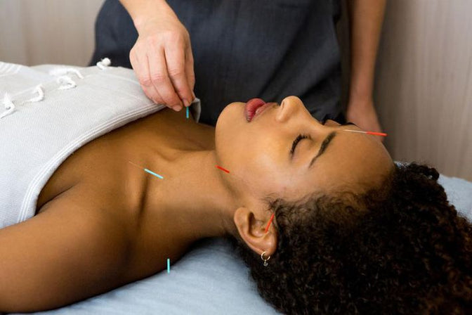 I Tried Facial Acupuncture–And Every Bit of Jaw and Forehead Tension Melted Away