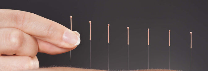 ASKED AND ANSWERED: DOES GETTING ACUPUNCTURE HURT—EVEN A LITTLE BIT?