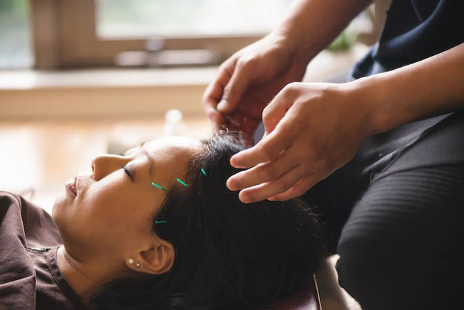 IS ACUPUNCTURE THE LATEST OLD-BUT-NEW-AGAIN WELLNESS PRACTICE TO GO MAINSTREAM?