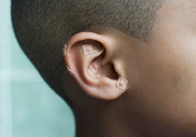 I Wore Ear Seeds for Five Days and My Chronic Anxiety Disappeared