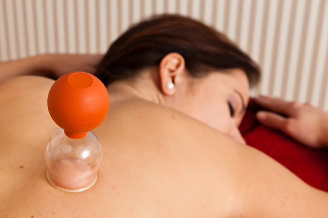 Here’s Everything You Need to Know About the At-Home Cupping Trend